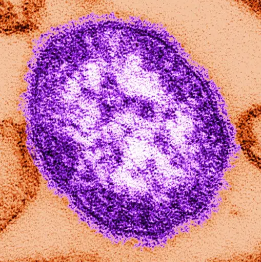 MEASLES