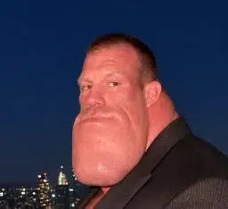 Chin