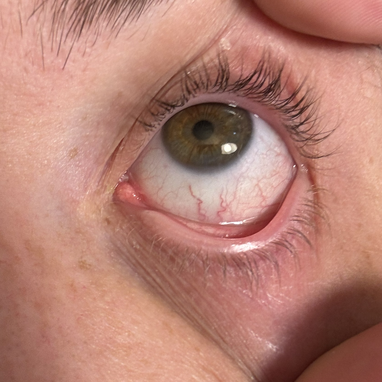 MYEYE