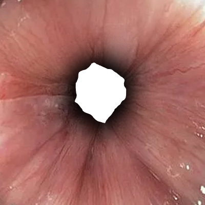 FARTPOV