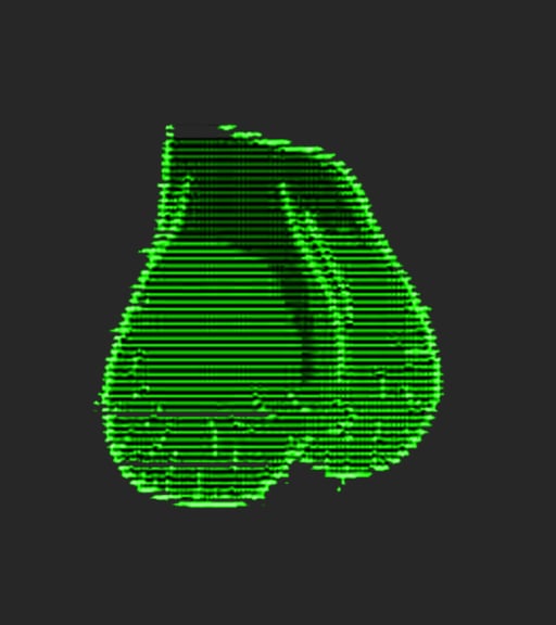 TESTICLES