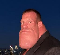 Chin
